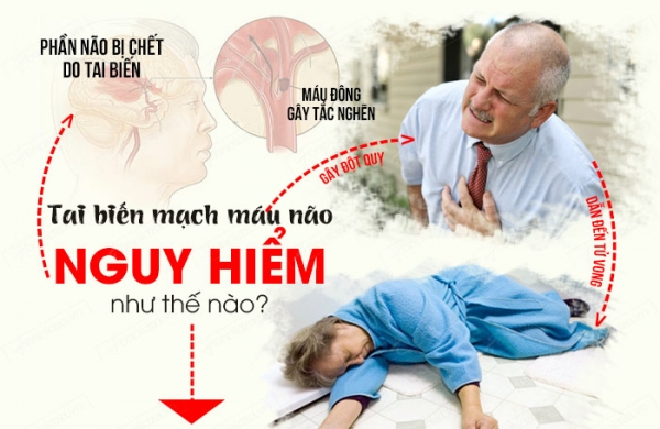 Tai biến mạch máu não: Bệnh lý nguy hiểm và những điều cần biết